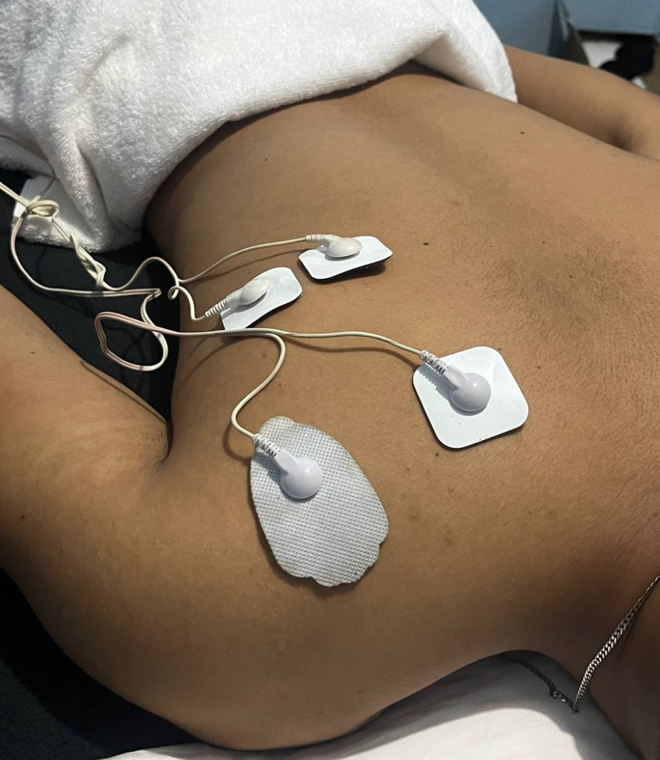 equipos electroterapia